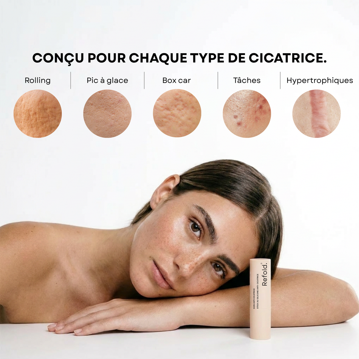 Stick Clinique — Réparateur cicatrices d'acné